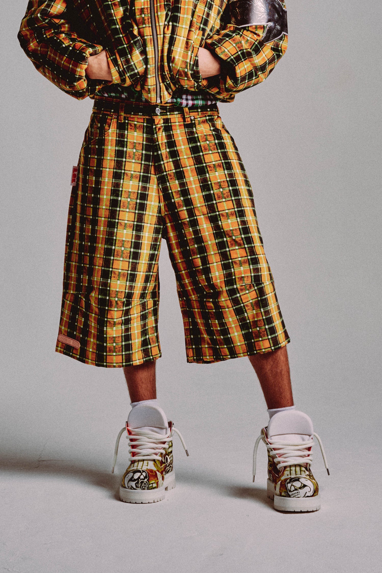 KNEE SHORT // YELLOW CHECK